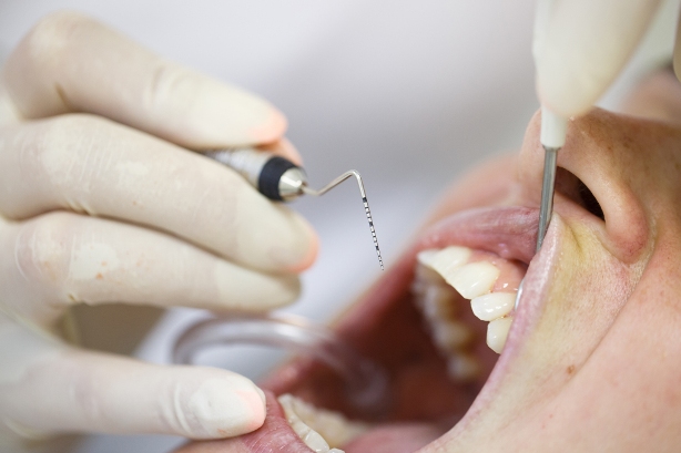 Когда показано удаление зубов перед протезированием?