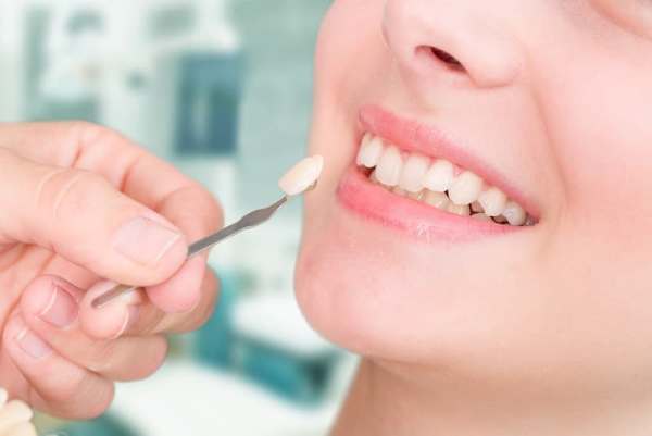 Что такое люминиры на зубы, установка в стоматологии Москвы