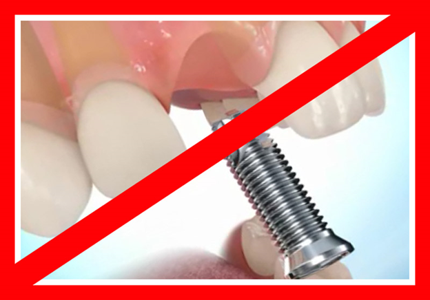 Зубные импланты. Противопоказания к установке